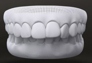 Invisalign in Panama