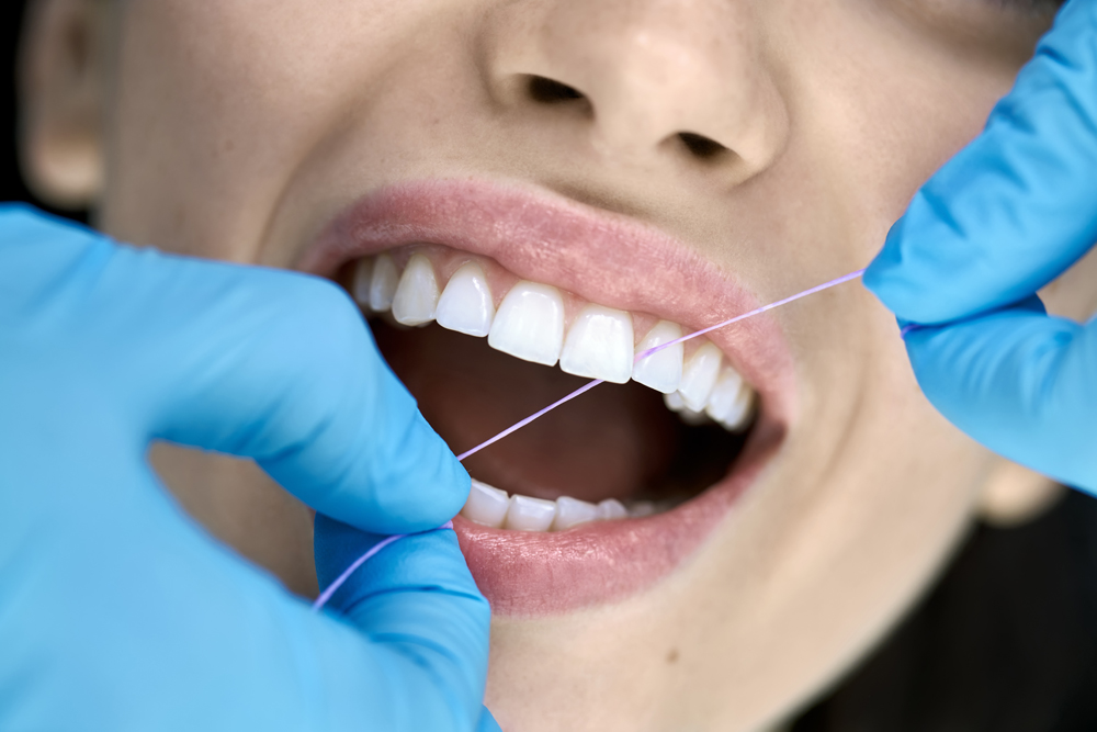 Is Dental Cleaning Important?