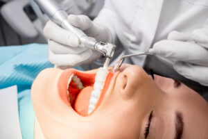 ¿Cada cuanto debo ir a mi consulta dental en Panamá?