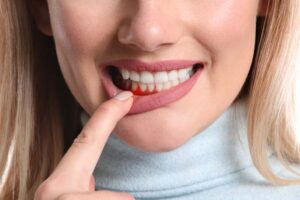 ¿Qué es la cirugía periodontal?