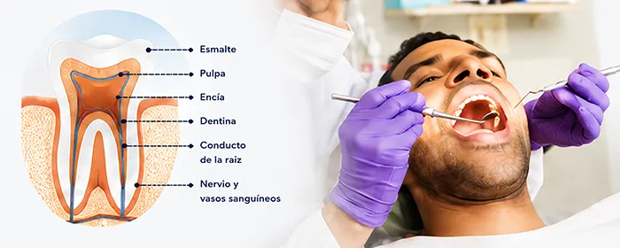 Endodoncia en Panama