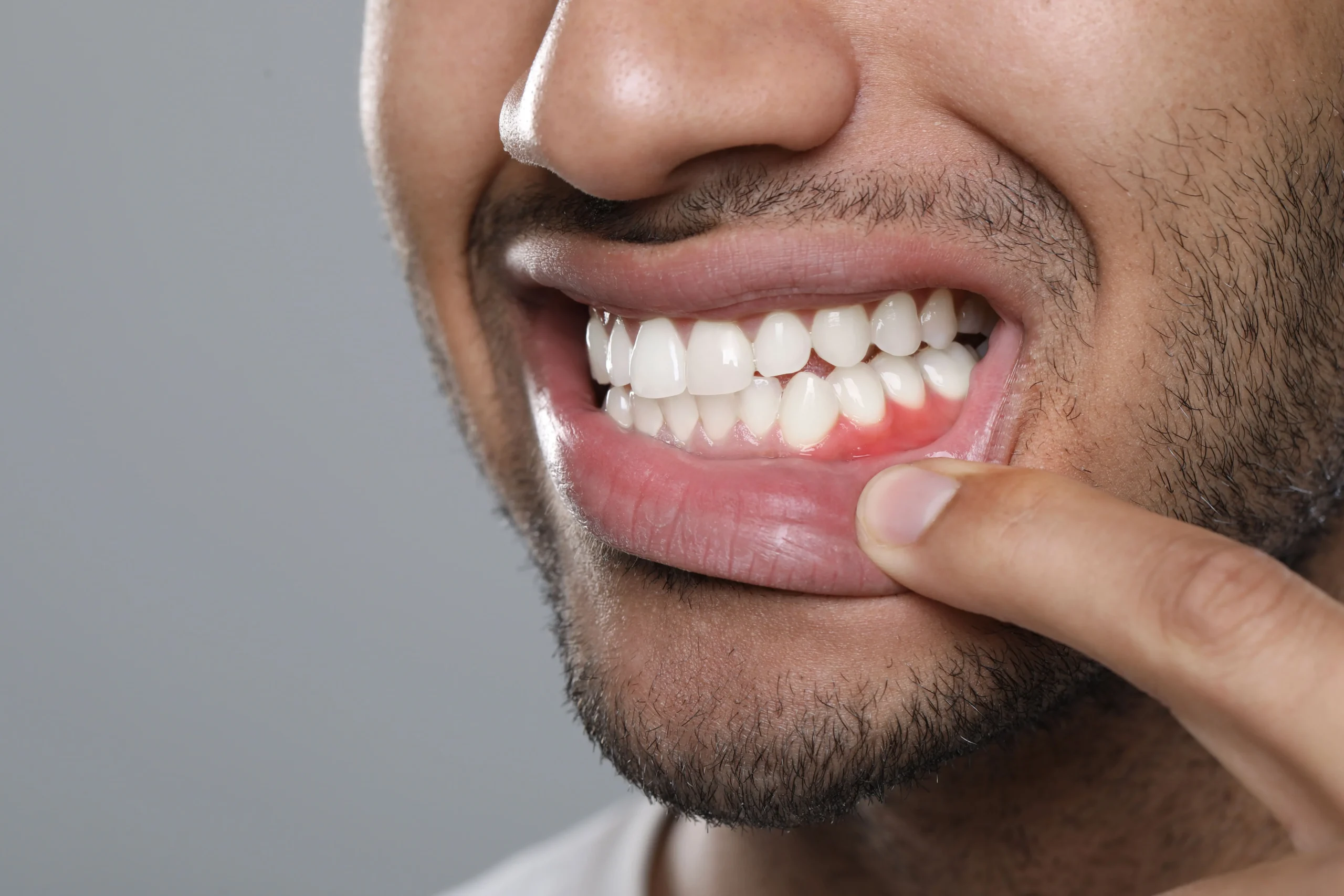 Periodoncia en Panamá