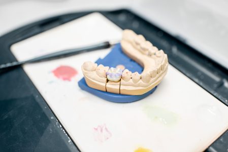 corona dental_clinica dental champsaur